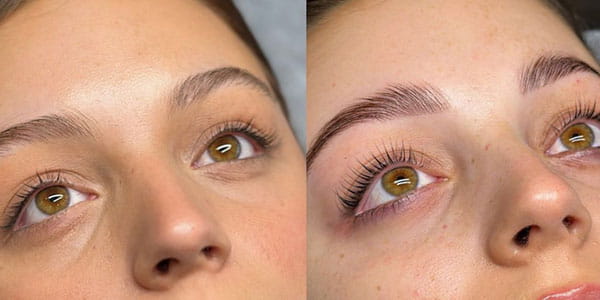 Tips for Better Before-and-After Results